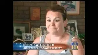 Life Saving Surgery