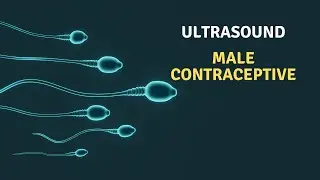 Ultrasound: Male Contraception