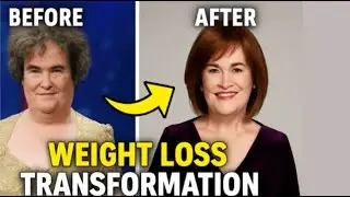 Susan Boyle&rsquo;s Shocking Weight Loss Transformation: From BGT Star to Glamorous Icon