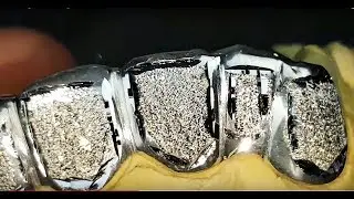 Dazzling 925 Sterling Silver Custom Grillz Diamond Dust Real Teeth Grills!