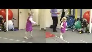 Before and after: excess plantarflexion - toe walking | DAFO 2 | Cascade Dafo