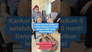 Kanker prostat stadium 4 setelah diterapi banyak toksin keluar lewat Keringat