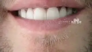 biusmile