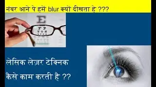 laser eye surgery | lasik eye surgery | laser treatment for eye