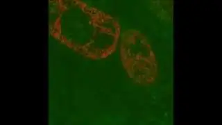 EGFP fusion protein - confocal microscope