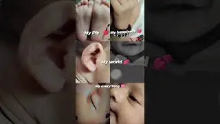 Cute Baby Photo Shoot | Close-Up Face, Eyes, Ears, Hands & Legs