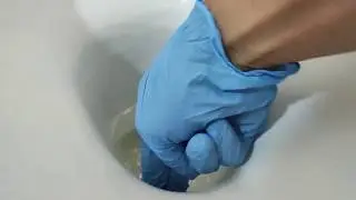 How to remove toilet bowl ring stain.
