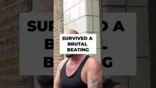 STREET SMARTS: Terrifying Moment: Surviving a Severe Injury-Vancouver, BC-Anonymous #survivalstory