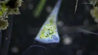 Vista microscopica de microorganismos de la Albufera de Valencia(9-10-25)