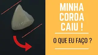 Minha Coroa Caiu - O que eu Fa&ccedil;o ?