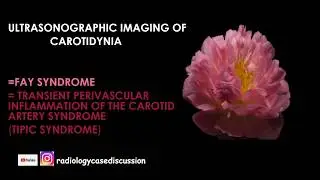 1-🟣💉CAROTIDYNIA (= FAY SYNDROME = TIPIC  SYNDROM)⚕️ULTRASONOGRAPHIC IMAGING
