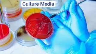 Culture Media | Microbiology | Culture Sensitivity Test | Creative Zone Plus