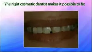 Cosmetic Dentistry Dentist La Mesa 619) 444-1001 Dental Arts Group