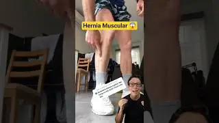 Hernia Muscular 😱 #medicina #medico #enfermagem #enfermeiro #enfermeira Varizes na perna