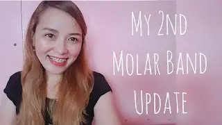 My 2nd Molar Band Update