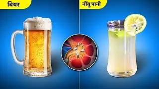 पथरी को निकालने के लिए क्या पीना चाहिए - बियर या नींबू पानी - Beer vs Lemon water - kidney stone 