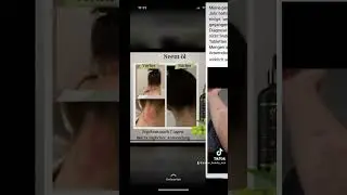 #viral #virareels #viralvideo #neem&ouml;l #eselsmilch #hilfe#haut#pflege #heilung