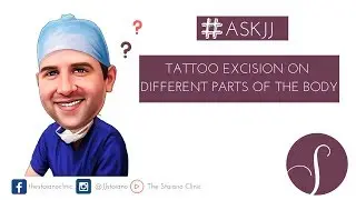 Can I have my Tattoo Excised? (cut out of the skin)