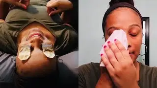 How To Use Tea Bags for Puffy Eyes: DIY to Reduce Dark Circles & Swollen Eyes