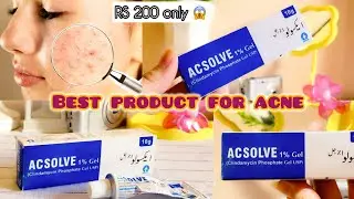 Magical product for acne ( Acsolve Clindamycin gel) honest review #acne 