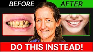 Healing Your Teeth Naturally at Home &ndash; Dr. Barbara O'Neil's Expert Advice!