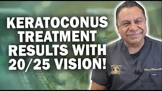 Keratoconus Treatment Results with Topography and Overall Correction