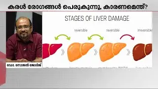 കരൾ രോ​ഗത്തിന് കാരണങ്ങളെന്തെല്ലാം... ചികിത്സ എങ്ങനെ ? | Liver Diseases | Medicine