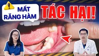 Tác Hại Của Việc Mất Răng Hàm: 5 Sự Thật Kinh Hoàng, Đừng Xem Nhẹ! Phải Làm Gì Để Khắc Phục?