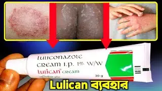 Lulican Cream Uses In Bangla | Lulican Cream | Lulican Cream Review (Luliconazol Cream)