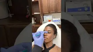 📍FRISCO TEXAS MEDSPA #dallas #frisco #texas