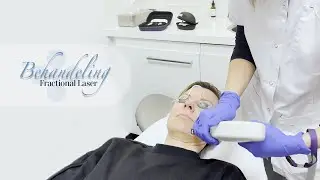 Fractional laser behandeling - Wat kan je verwachten?