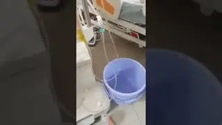 double filtration plasma pherises/plasma filter/plasam pherises