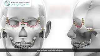 Advanced Oral & Maxillofacial Surgery at MASH | Led by Dr. Waqas Ahmed