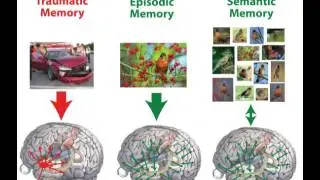 How the Brain Works: Conscious Memory, Video 10 of 20