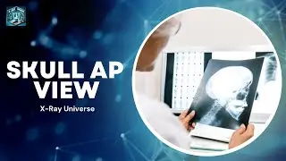 Skull AP View (Radiography Positioning)