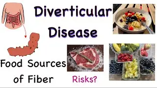 Diet and Lifestyle for Diverticular Disease (Lots of Fiber!)