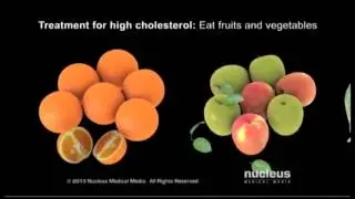 Hyperlipidemia