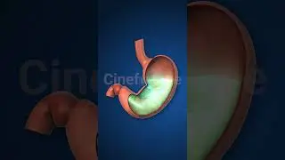 Antacid Acting Against Stomach Acid stock footage | stock video | Cinefootage