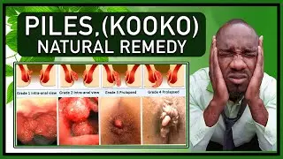 Natural Treatment for Piles (Hemorrhoids) | Forever Living Products with Aloe Vera Gel