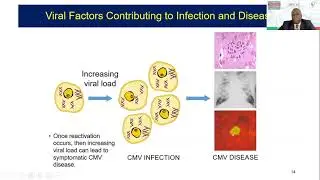 Post-Transplant Infectious Diseases in honor of National Minority Donor Awareness Month