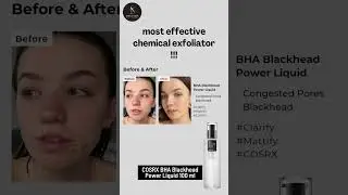 COSRX BHA Blackhead Power Liquid #cosrx #benefit #skincare #beauty