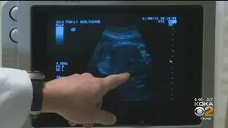 Kidsburgh: New Pittsburgh Law Protects Pregnant Women And Their Partners