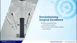 Robot-Assisted Surgery | Makati Medical Center (MakatiMed)