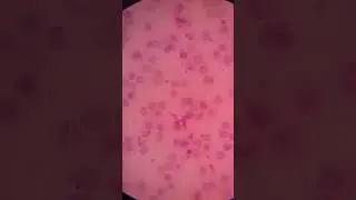 How to identify#malaria trophozoites under a microscope. #amazing #video