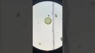 Volvox Algae under a Microscope