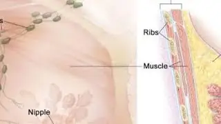 Topic#Breast examination # learn to a breast self- examination at home&copy; subscribe 