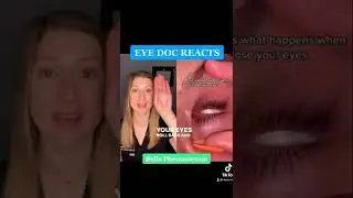 Extreme Eye Rolling?! Eye Doctor Explains #eyeroll #bellsreaction #eyedoctor #eyehealth #reflexes