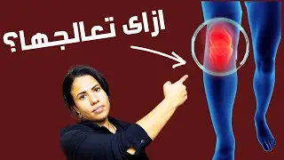 تخلص من الم الركبة فورا | كلام لم تسمعه من قبل