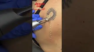 #dermainkdetatouageaulaser #picosurelaser #tattoo
