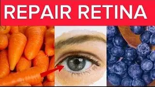 TOP 15 FOODS To IMPROVE EYE HEALTH  | Eat for Clear Vision
